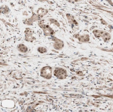 COIL antibody|COIL抗体