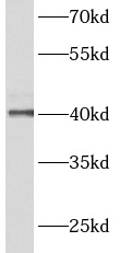 ACTRT2 antibody|ACTRT2抗体