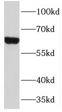 TMEM87A antibody|TMEM87A抗体