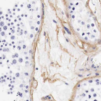 BGLAP antibody|BGLAP抗体 FNab060