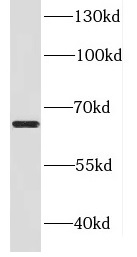 DDX52 antibody|DDX52抗体