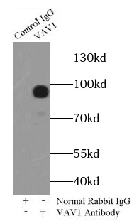 TSC22D2 antibody|TSC22D2抗体