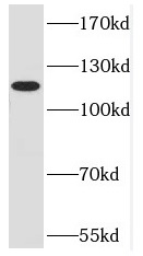 DNMT3A antibody|DNMT3A抗体 FNab0