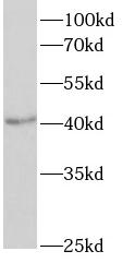 QPCT antibody|QPCT抗体