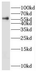 PRPF4 antibody|PRPF4抗体