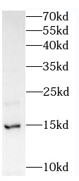 FABP6 antibody|FABP6抗体