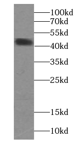 Creatine Kinase MM-Specific an