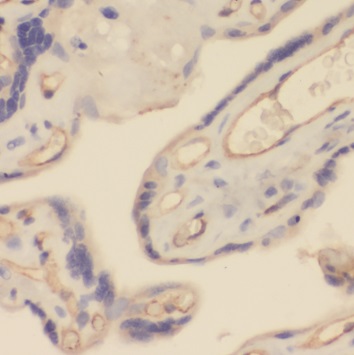 TRPC6 antibody|TRPC6抗体