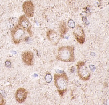 RTN1-A antibody|RTN1-A抗体