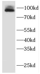 EWSR1 antibody|EWSR1抗体 FNab028