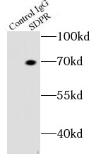 RNF181 antibody|RNF181抗体