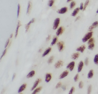 TP73 antibody|TP73抗体