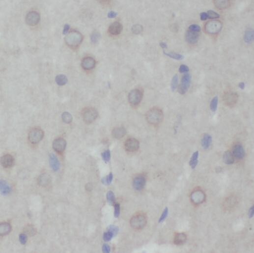 PRMT8 antibody|PRMT8抗体