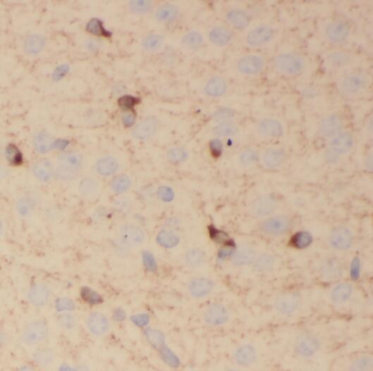 PCDHA3 antibody|PCDHA3抗体