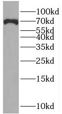 SLC5A8 antibody|SLC5A8抗体