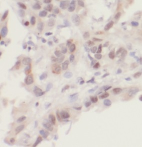 UBE2I antibody|UBE2I抗体 FNab091