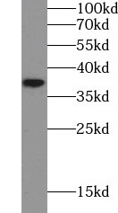 AKR1C2 antibody|AKR1C2抗体