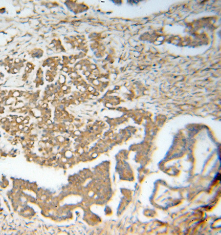 RABEPK antibody|RABEPK抗体 FNab0