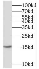 CST3 antibody|CST3抗体 FNab10197