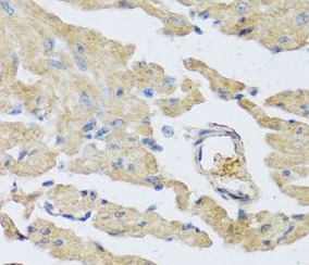 UCN2 antibody|UCN2抗体