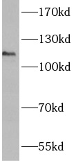 ANO3 antibody|ANO3抗体