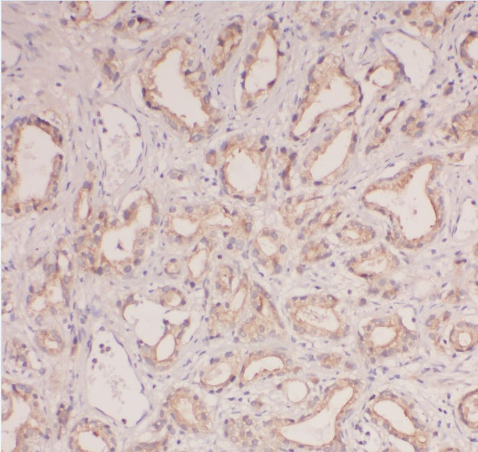 ABHD14B antibody|ABHD14B抗体