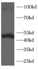 GSDMD-N antibody|GSDMD-N抗体