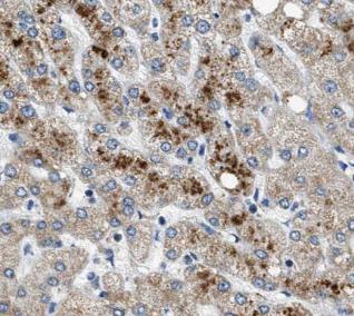 C1R antibody|C1R抗体 FNab09885