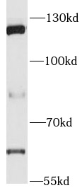 PARP1 antibody|PARP1抗体 FNab061