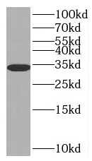 SULT1E1 antibody|SULT1E1抗体