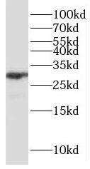 P4HA3 antibody|P4HA3抗体