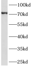 GHR antibody|GHR抗体