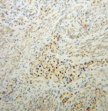 IRF2BP1 antibody|IRF2BP1抗体