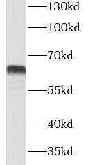 CNOT4 antibody|CNOT4抗体