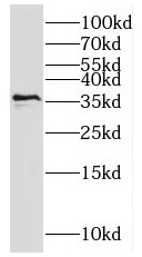 MNAT1 antibody|MNAT1抗体