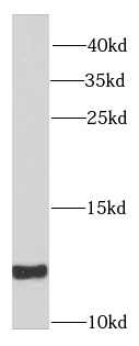 SNRPE antibody|SNRPE抗体
