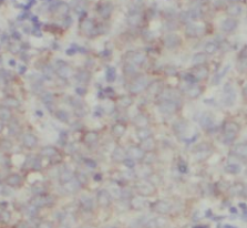 VAPB antibody|VAPB抗体 FNab09371