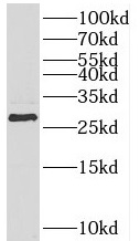 HOXB7 antibody|HOXB7抗体