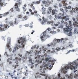 TTF2 antibody|TTF2抗体