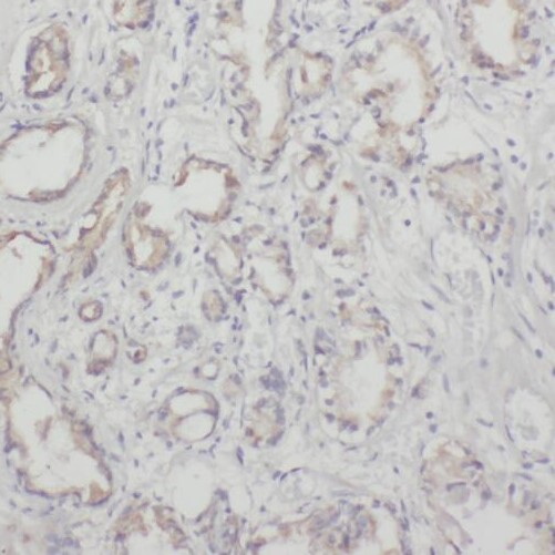 NECTIN3 antibody|NECTIN3抗体