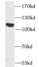 RECK antibody|RECK抗体 FNab07224