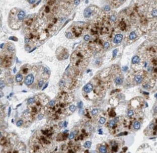 TFF2 antibody|TFF2抗体