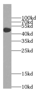 TTC8 antibody|TTC8抗体
