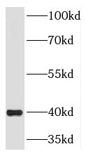 DNAJA3 antibody|DNAJA3抗体