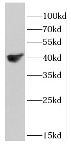 DSN1 antibody|DSN1抗体