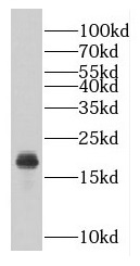 GEMIN6 antibody|GEMIN6抗体