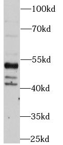 PTEN antibody|PTEN抗体 FNab09821