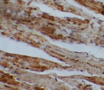 SFTPB antibody|SFTPB抗体 FNab077