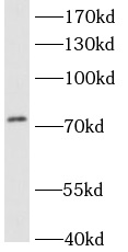 ACSL3 antibody|ACSL3抗体