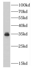 CDK5 antibody|CDK5抗体